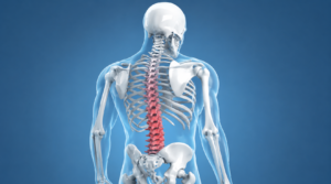Back Pain Keeps Coming Back