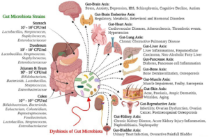 Gut Health and Chronic Back Pain